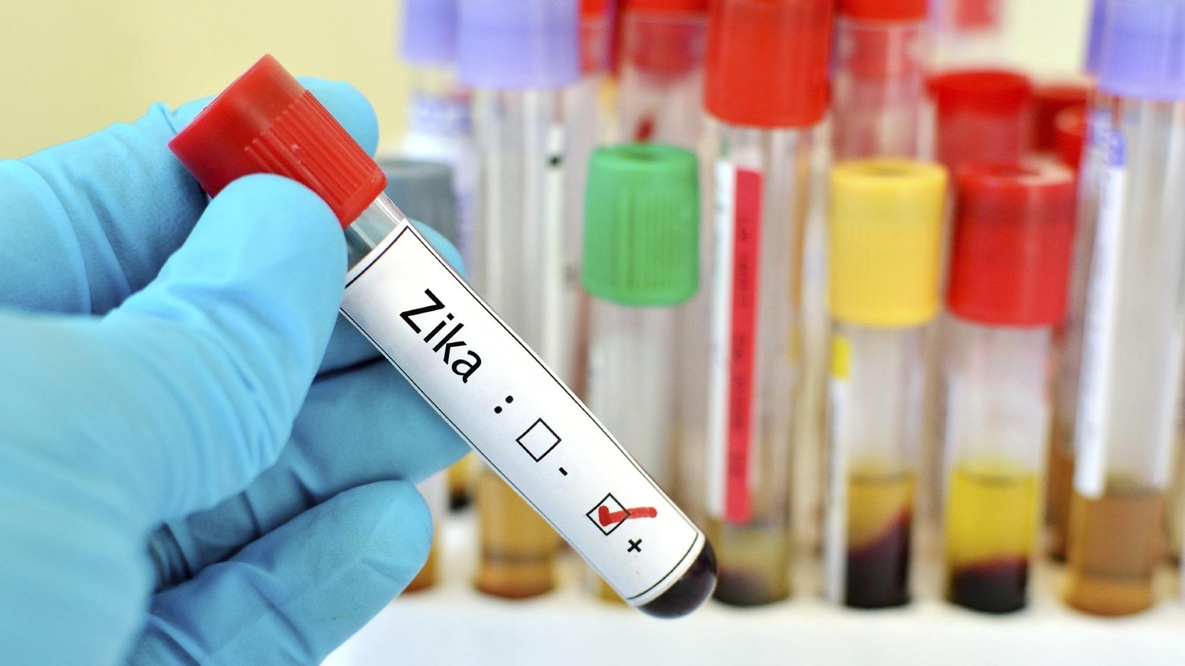 First case of Zika spread by sex from woman to man | Luxembourg Times